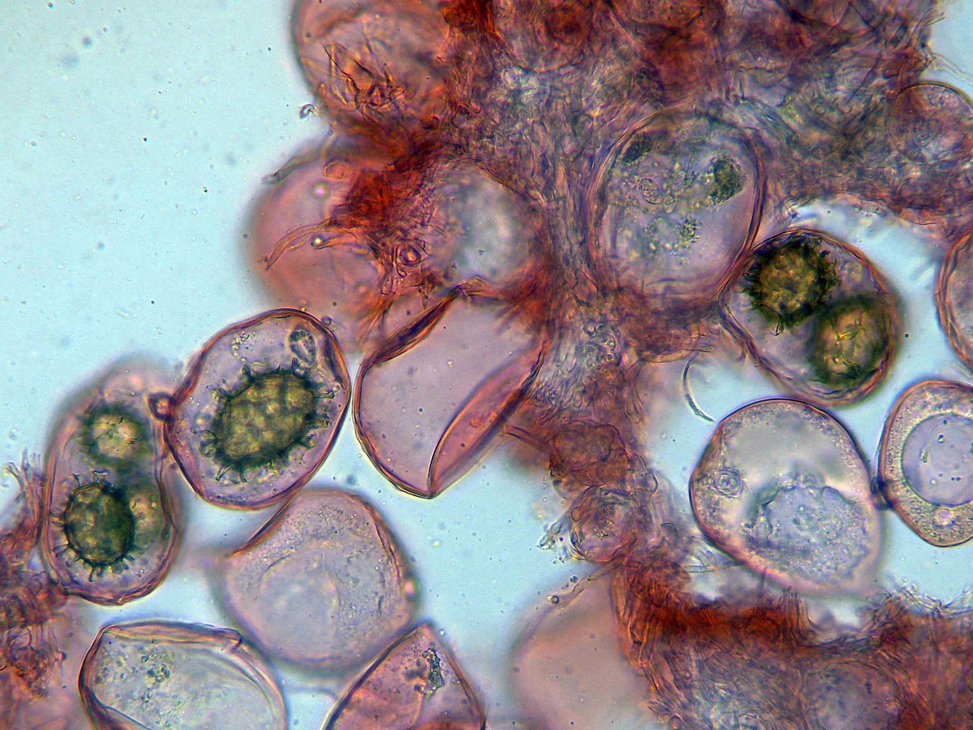 Microscopía de Tuber bituminatum - 10 - Ascos x 400-001